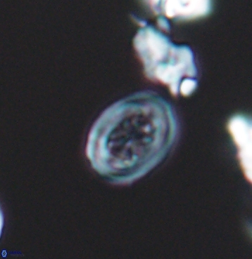 Chiastozygus spissus 11298