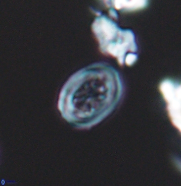 Chiastozygus spissus 11299