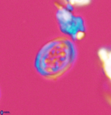 Chiastozygus spissus 11300