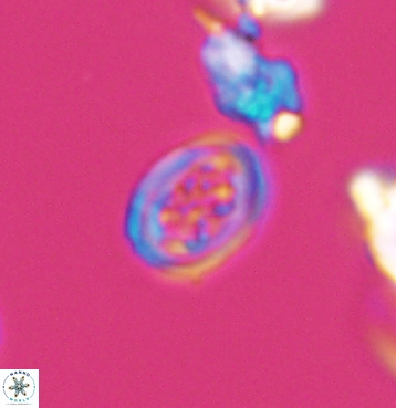 Chiastozygus spissus 11300