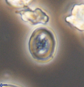 Chiastozygus spissus 11301