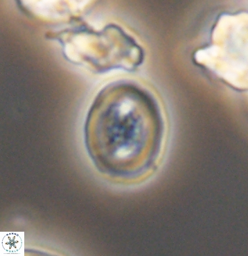 Chiastozygus spissus 11301