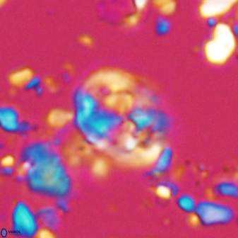 Chiastozygus planus 13300