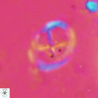 Chiastozygus platyrhethus 14457