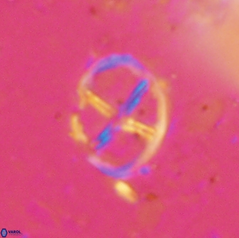 Chiastozygus platyrhethus 14453