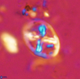 Chiastozygus platyrhethus 14574