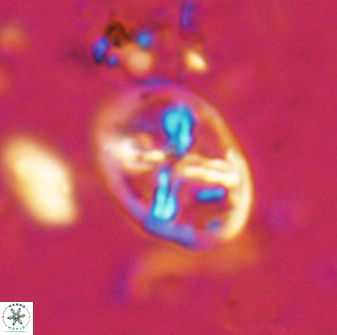 Chiastozygus platyrhethus 14574