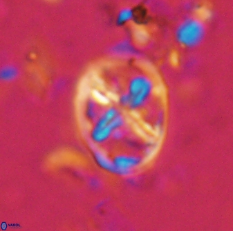 Chiastozygus platyrhethus 14575