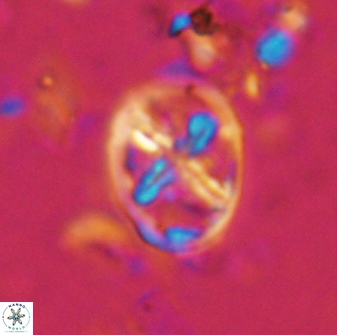 Chiastozygus platyrhethus 14575