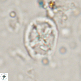 Chiastozygus platyrhethus 14579