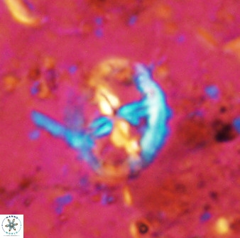 Chiastozygus platyrhethus 48803