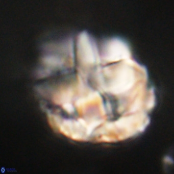 Chiphragmalithus acanthodes VR 30355