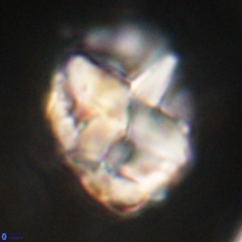 Chiphragmalithus acanthodes VR 30361