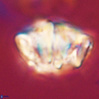 Chiphragmalithus acanthodes VR 30364