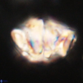 Chiphragmalithus acanthodes VR 30365