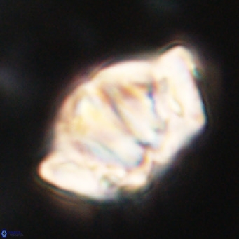 Chiphragmalithus acanthodes VR 30366