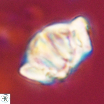Chiphragmalithus acanthodes VR 30367