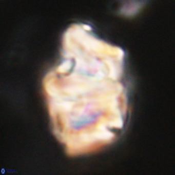 Chiphragmalithus acanthodes VR 30369