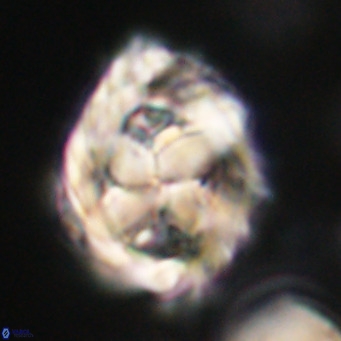 Chiphragmalithus acanthodes VR 30370
