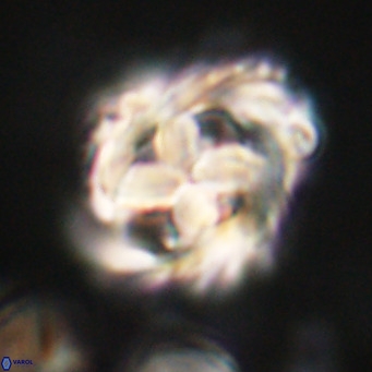 Chiphragmalithus acanthodes VR 30373