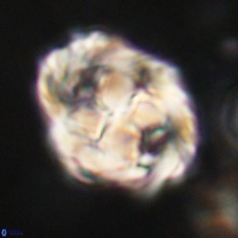 Chiphragmalithus acanthodes VR 30374