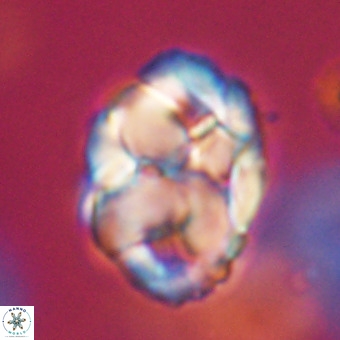 Chiphragmalithus calathus VR 29774