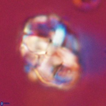 Chiphragmalithus calathus VR 29775