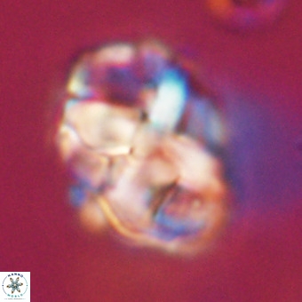 Chiphragmalithus calathus VR 29775