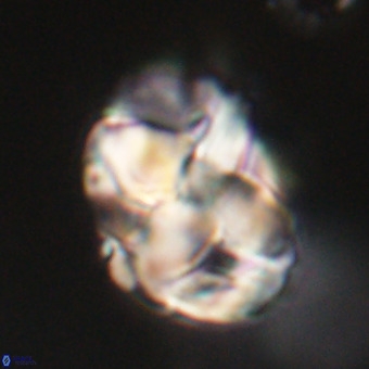 Chiphragmalithus calathus VR 29777