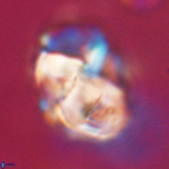 Chiphragmalithus calathus VR 29778