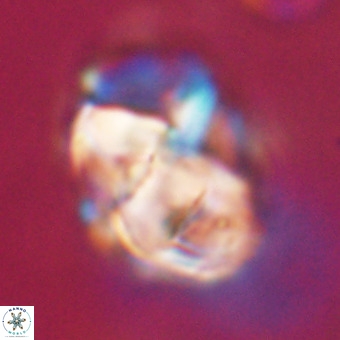 Chiphragmalithus calathus VR 29778