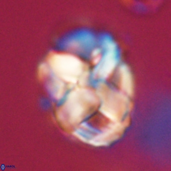 Chiphragmalithus calathus VR 29779