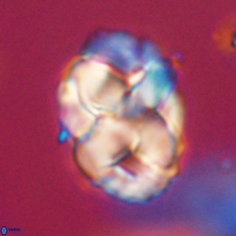 Chiphragmalithus calathus VR 29771