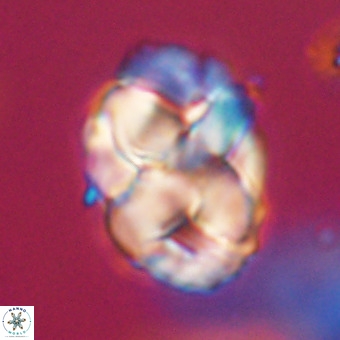 Chiphragmalithus calathus VR 29771
