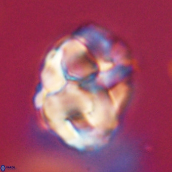 Chiphragmalithus calathus VR 29772