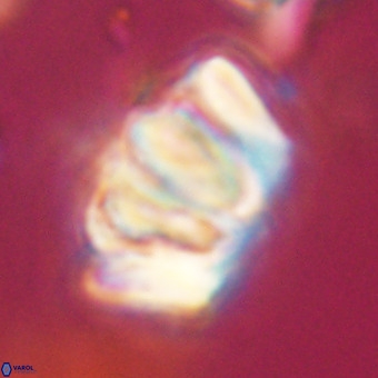 Chiphragmalithus calathus VR 29784