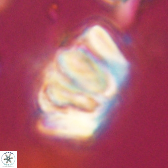 Chiphragmalithus calathus VR 29784