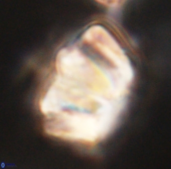 Chiphragmalithus calathus VR 29785