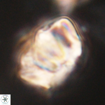 Chiphragmalithus calathus VR 29786