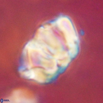 Chiphragmalithus calathus VR 29788