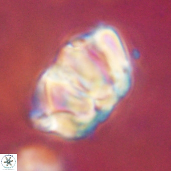 Chiphragmalithus calathus VR 29788