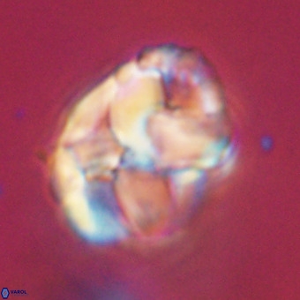 Chiphragmalithus calathus VR 29789