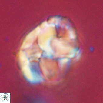 Chiphragmalithus calathus VR 29789