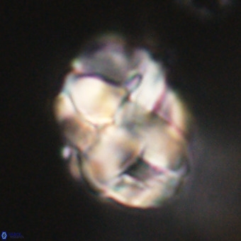 Chiphragmalithus calathus VR 29781