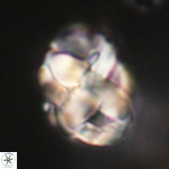 Chiphragmalithus calathus VR 29781