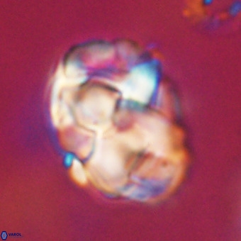 Chiphragmalithus calathus VR 29783