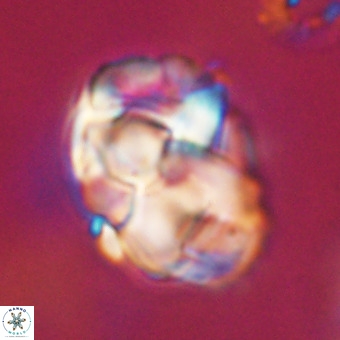 Chiphragmalithus calathus VR 29783