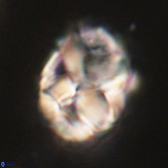 Chiphragmalithus calathus VR 29795
