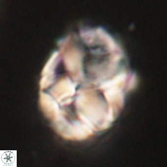 Chiphragmalithus calathus VR 29795
