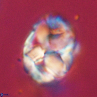 Chiphragmalithus calathus VR 29796